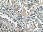 HSD17B6 Antibody in Immunohistochemistry (Paraffin) (IHC (P))