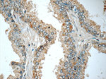 HSD17B6 Antibody in Immunohistochemistry (Paraffin) (IHC (P))