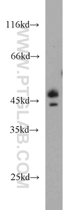 Caspase 4/p20/p10 Antibody in Western Blot (WB)