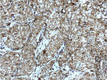 Galectin-1 Antibody in Immunohistochemistry (Paraffin) (IHC (P))