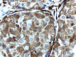 Galectin-1 Antibody in Immunohistochemistry (Paraffin) (IHC (P))