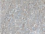 Galectin-1 Antibody in Immunohistochemistry (Paraffin) (IHC (P))