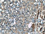 Galectin-1 Antibody in Immunohistochemistry (Paraffin) (IHC (P))