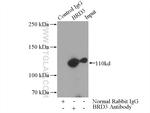 BRD3 Antibody in Immunoprecipitation (IP)