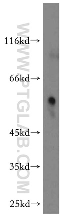 RAMP3 Antibody in Western Blot (WB)