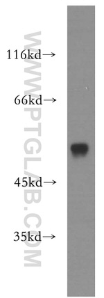 RAMP3 Antibody in Western Blot (WB)