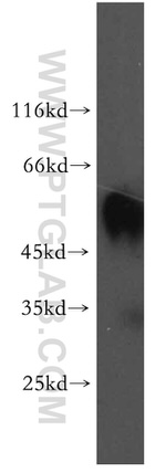 RAMP3 Antibody in Western Blot (WB)