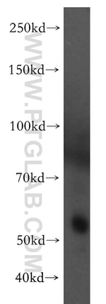 RAMP3 Antibody in Western Blot (WB)