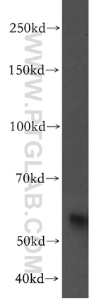 RAMP3 Antibody in Western Blot (WB)