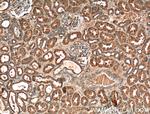 VPS37A Antibody in Immunohistochemistry (Paraffin) (IHC (P))