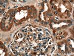 VPS37A Antibody in Immunohistochemistry (Paraffin) (IHC (P))