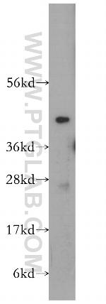 VPS37A Antibody in Western Blot (WB)