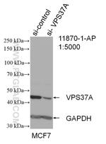 VPS37A Antibody in Western Blot (WB)