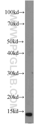 SH2D1B Antibody in Western Blot (WB)