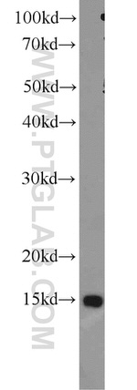 SH2D1B Antibody in Western Blot (WB)