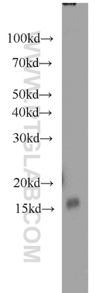 SH2D1B Antibody in Western Blot (WB)