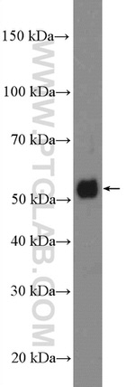 TIM3 Antibody in Western Blot (WB)