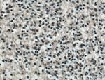 KLF4 Antibody in Immunohistochemistry (Paraffin) (IHC (P))