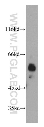 KLF4 Antibody in Western Blot (WB)