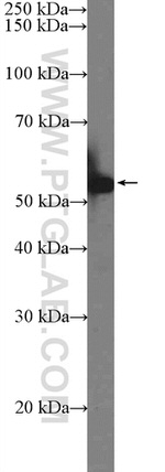 KLF4 Antibody in Western Blot (WB)