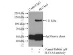 SLC4A4 Antibody in Immunoprecipitation (IP)