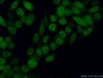 PSMA3 Antibody in Immunocytochemistry (ICC/IF)