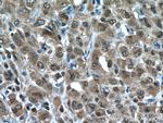 PSMA3 Antibody in Immunohistochemistry (Paraffin) (IHC (P))