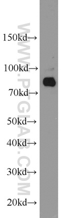 AGGF1 Antibody in Western Blot (WB)