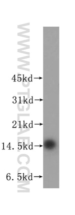 Prealbumin/transthyretin Antibody in Western Blot (WB)
