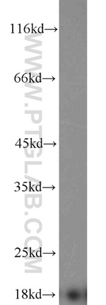 Prealbumin/transthyretin Antibody in Western Blot (WB)