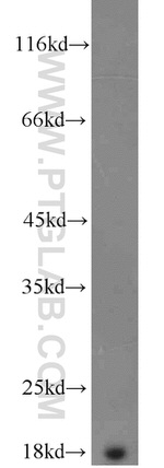 Prealbumin/transthyretin Antibody in Western Blot (WB)