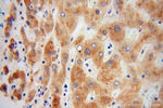 Prealbumin/transthyretin Antibody in Immunohistochemistry (Paraffin) (IHC (P))