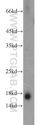 Prealbumin/transthyretin Antibody in Western Blot (WB)