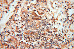 TERF1 Antibody in Immunohistochemistry (Paraffin) (IHC (P))