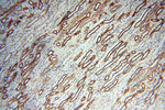 TERF1 Antibody in Immunohistochemistry (Paraffin) (IHC (P))