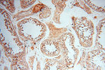 TERF1 Antibody in Immunohistochemistry (Paraffin) (IHC (P))