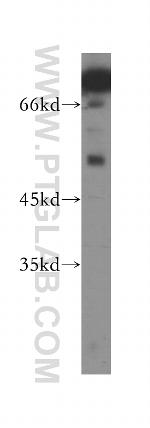 TERF1 Antibody in Western Blot (WB)