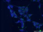 DGKE Antibody in Immunocytochemistry (ICC/IF)