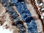 RGR Antibody in Immunohistochemistry (Paraffin) (IHC (P))