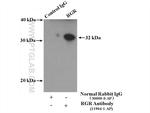 RGR Antibody in Immunoprecipitation (IP)