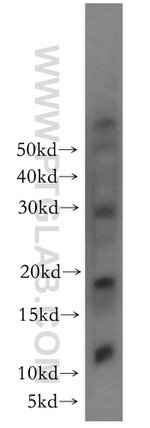 RNF7 Antibody in Western Blot (WB)