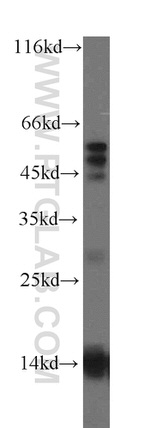 RNF7 Antibody in Western Blot (WB)