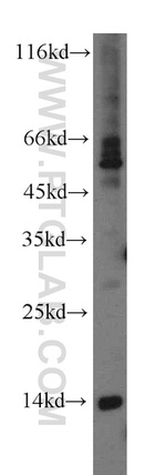 RNF7 Antibody in Western Blot (WB)