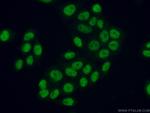 ATF2 Antibody in Immunocytochemistry (ICC/IF)