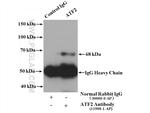 ATF2 Antibody in Immunoprecipitation (IP)