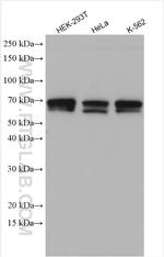 ATF2 Antibody in Western Blot (WB)