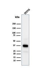 Clusterin/Apolipoprotein J (APO-J) Antibody in Western Blot (WB)