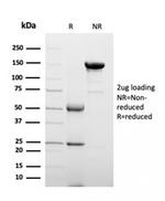 Clusterin/Apolipoprotein J (APO-J) Antibody in Immunoelectrophoresis (IE)