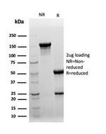 Clusterin/Apolipoprotein J (APO-J) Antibody in SDS-PAGE (SDS-PAGE)