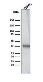 Clusterin/Apolipoprotein J (APO-J) Antibody in Western Blot (WB)